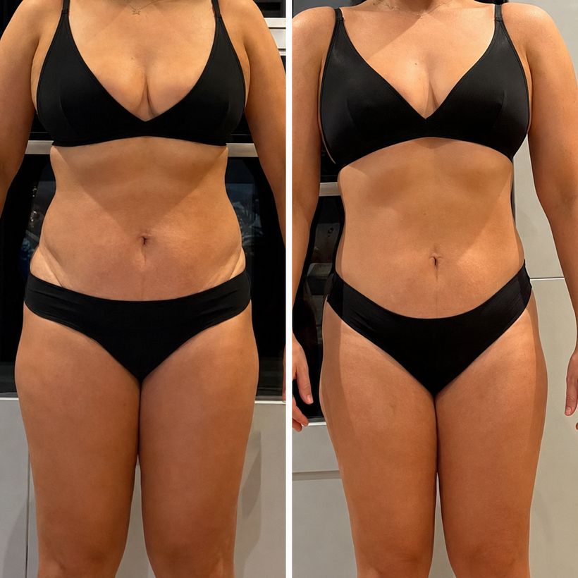Member body transformation result — before and after